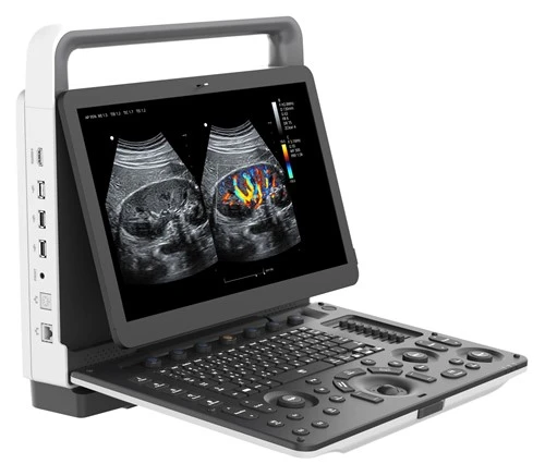 Portable Xim Doppler Ultrasound
